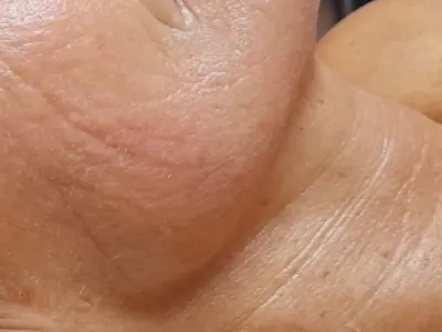 Viso — dopo il trattamento, dettaglio originale