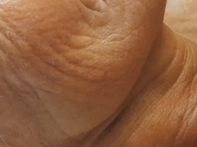 Viso — prima del trattamento, dettaglio originale